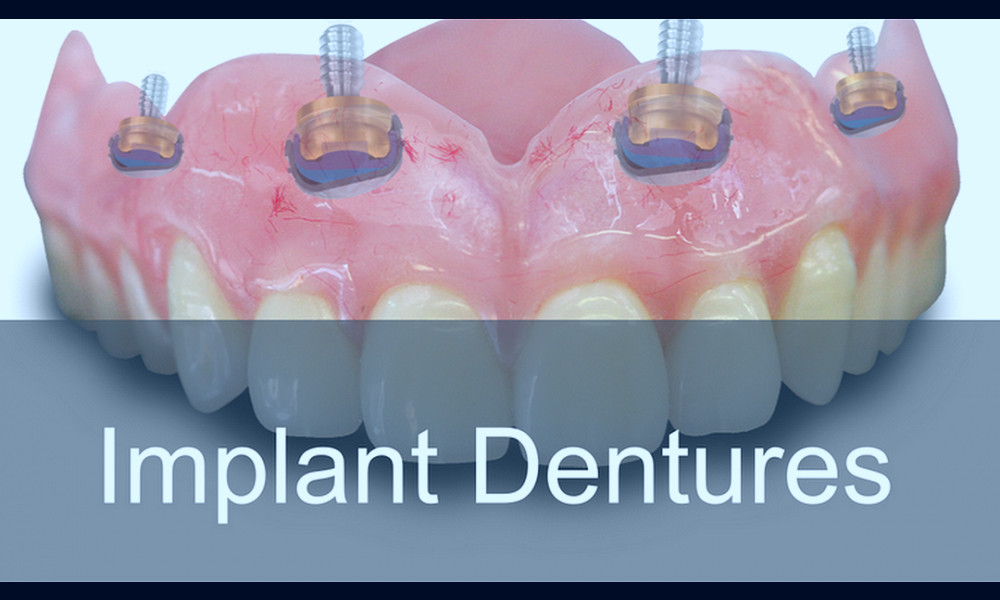 Abilene Dentures and Implants - Affordable Denture Care Center in Abilene
