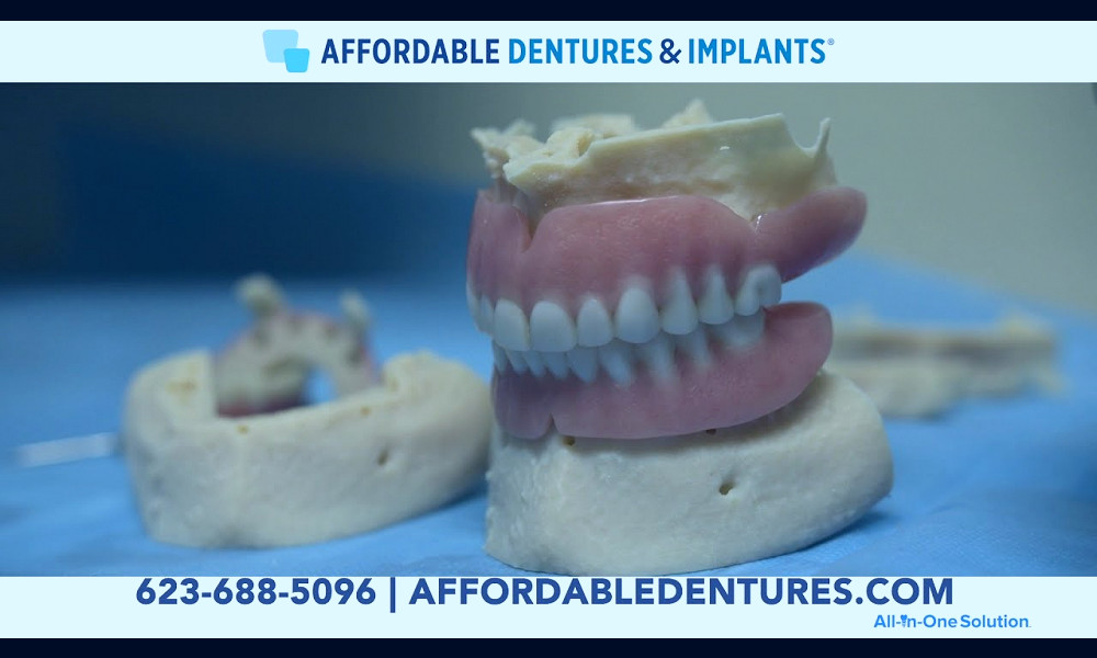 Dentures & Dental Implants in Bullhead City, AZ | Affordable Dentures &  Implants