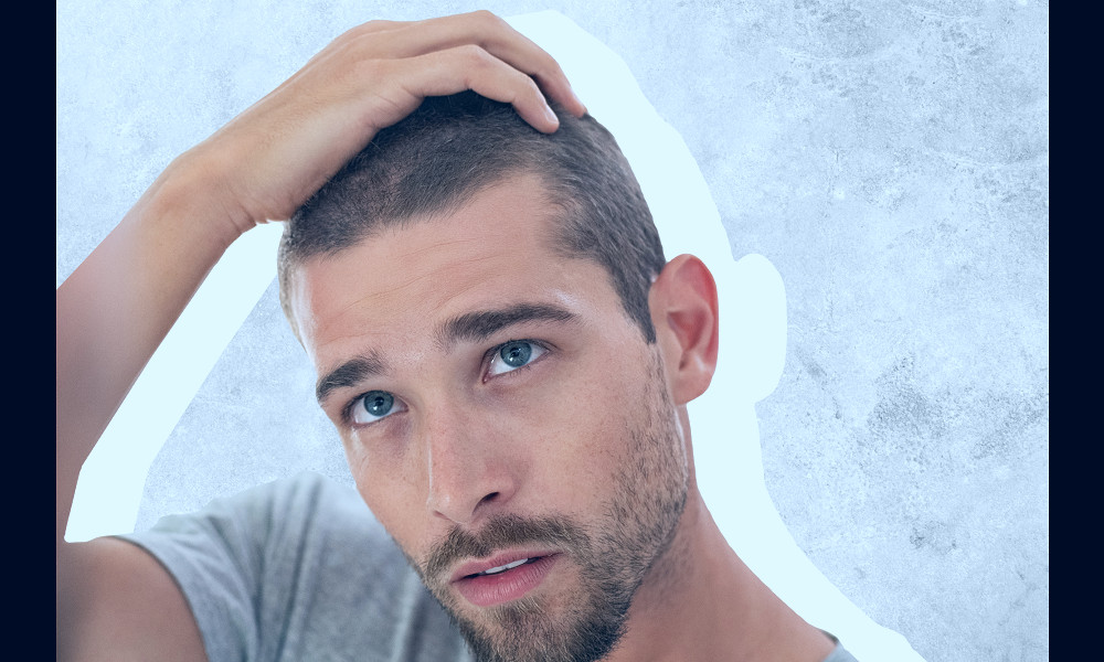 Hair loss treatment: Best options for men with thinning hair - The Manual
