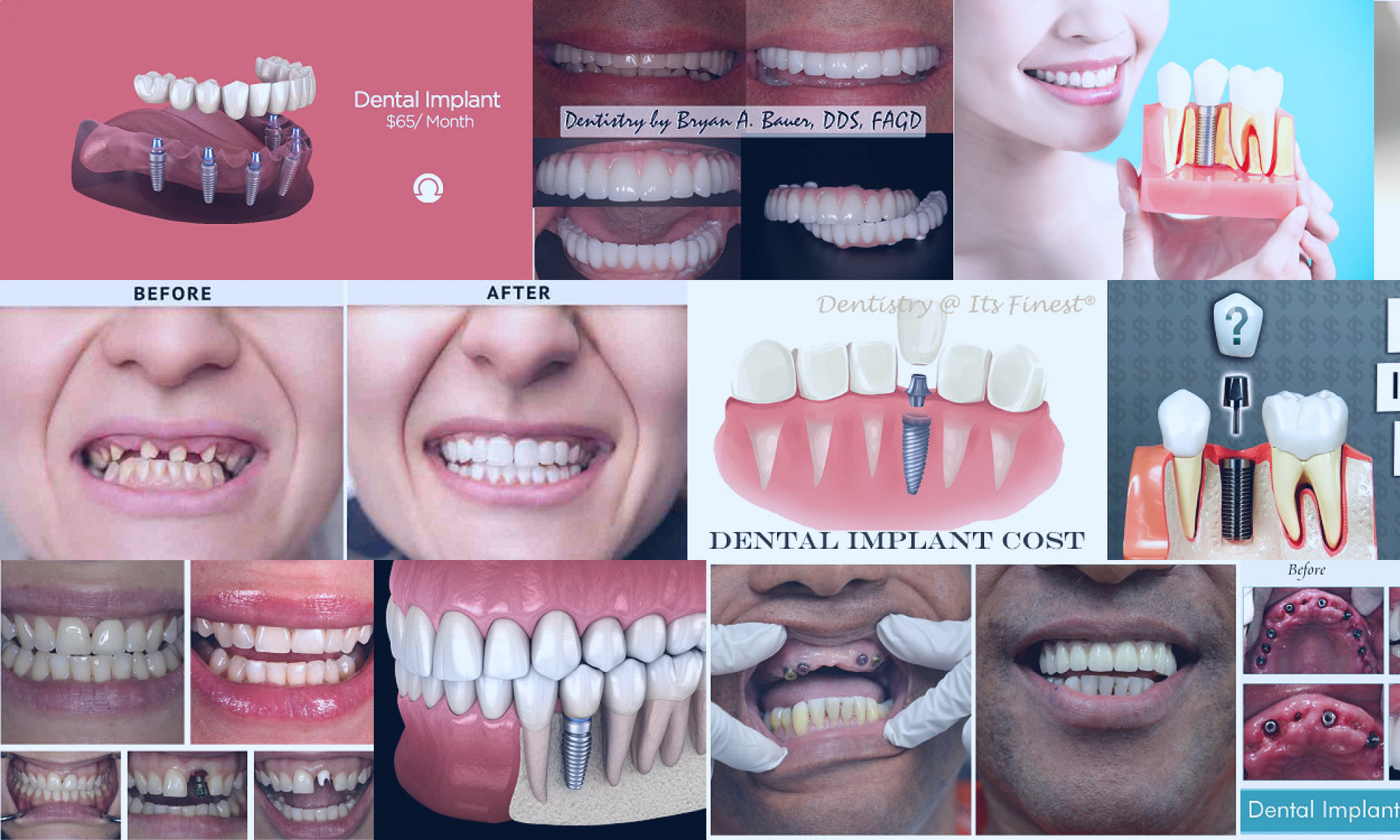 dental reconstruction cost