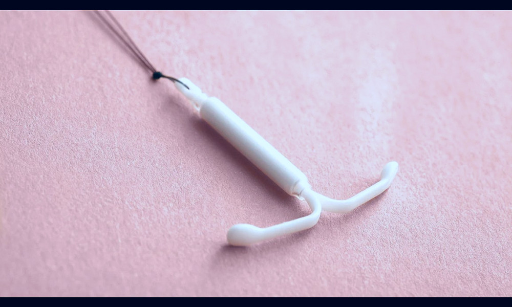 13 Things to Know About the Kyleena IUD