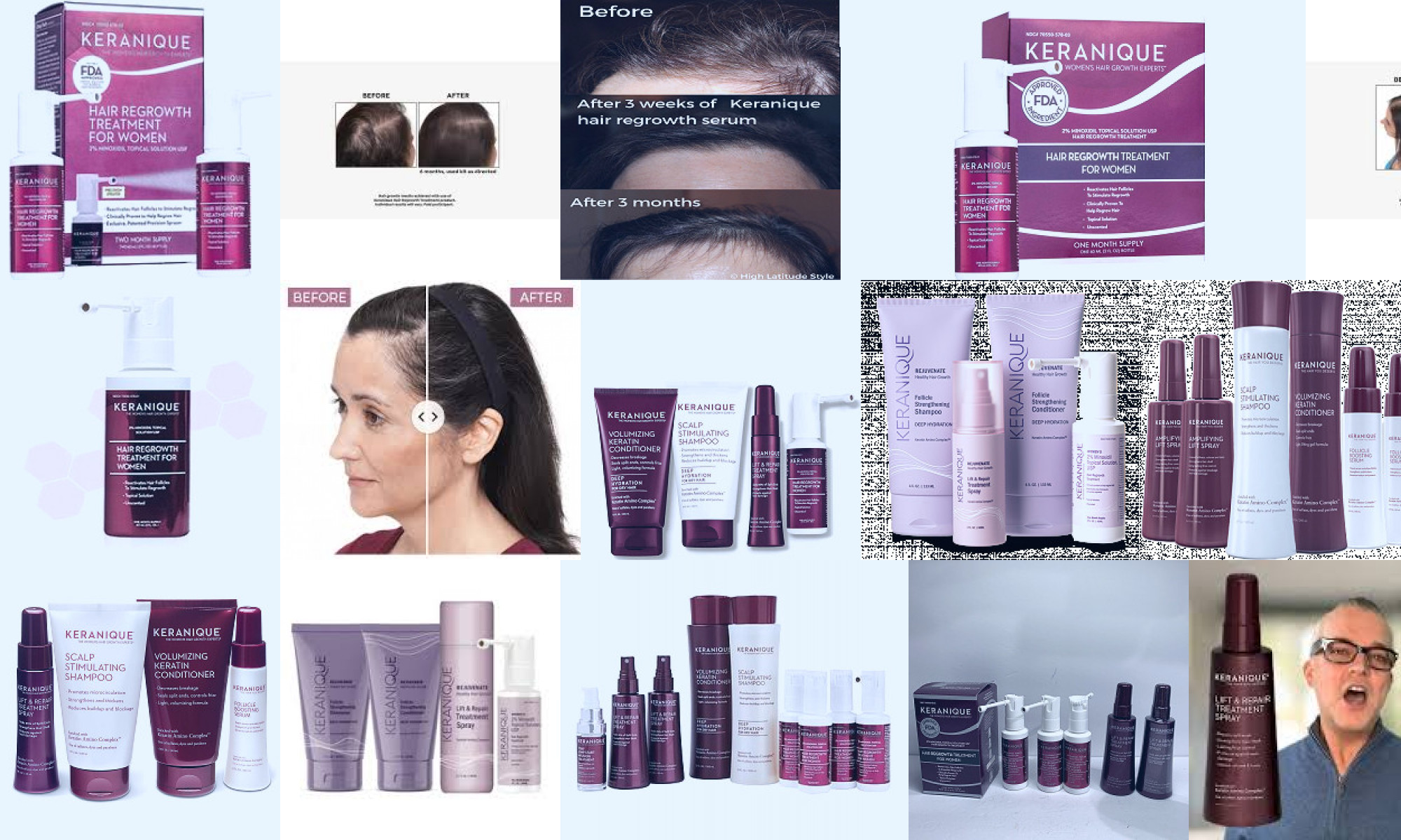 keranique hair regrowth system