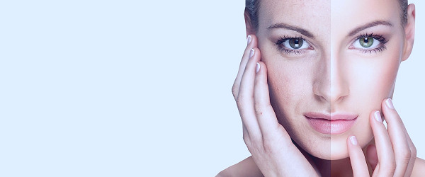 FAQs About Facial Rejuvenation
