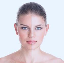 What is Skin Rejuvenation and How Does It Work? | The Dermatology Center Of  Indiana
