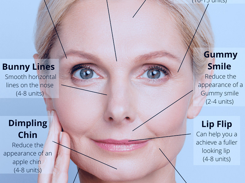 Botox Injections in Salt Lake City | Botulinum Toxin