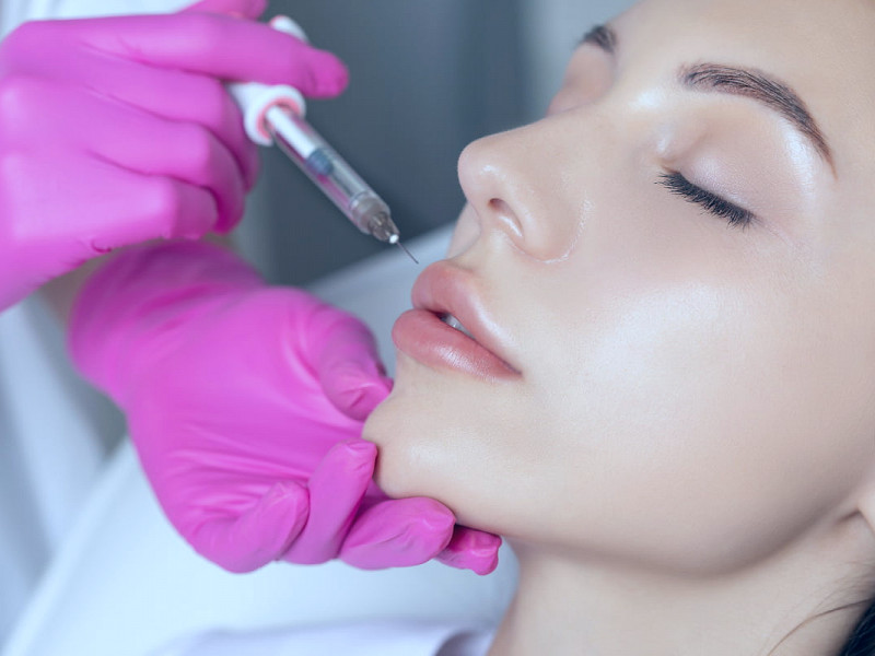 Heard about the BOTOX® lip flip? Here are the pros & cons. - American Board  of Facial Cosmetic Surgery