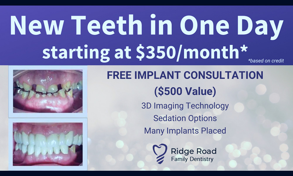 Cost of Dental Implants - Best Implant & Dentures Dentist in the Cleveland  Area