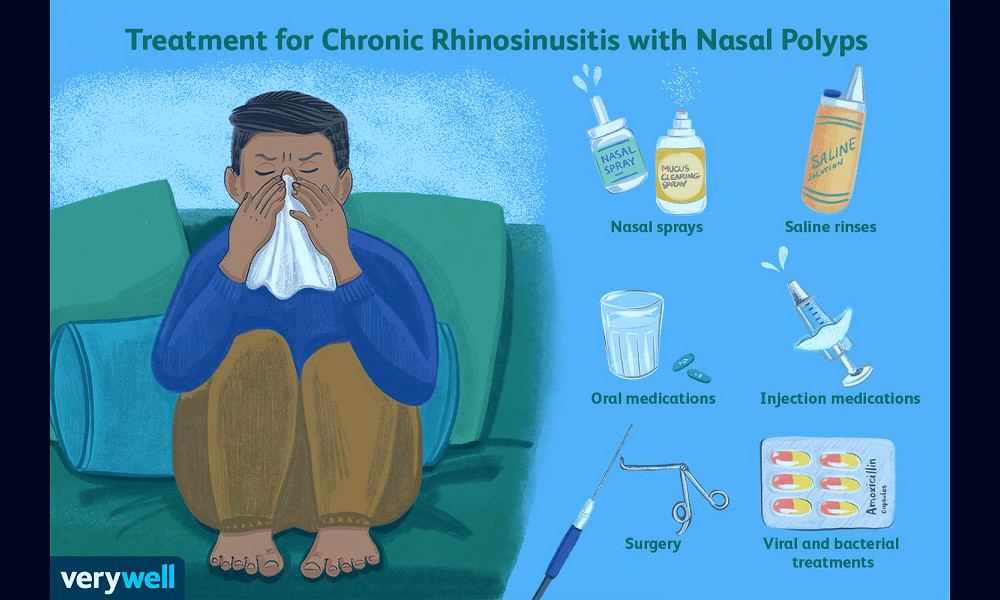 Chronic Rhinosinusitis With Nasal Polyps