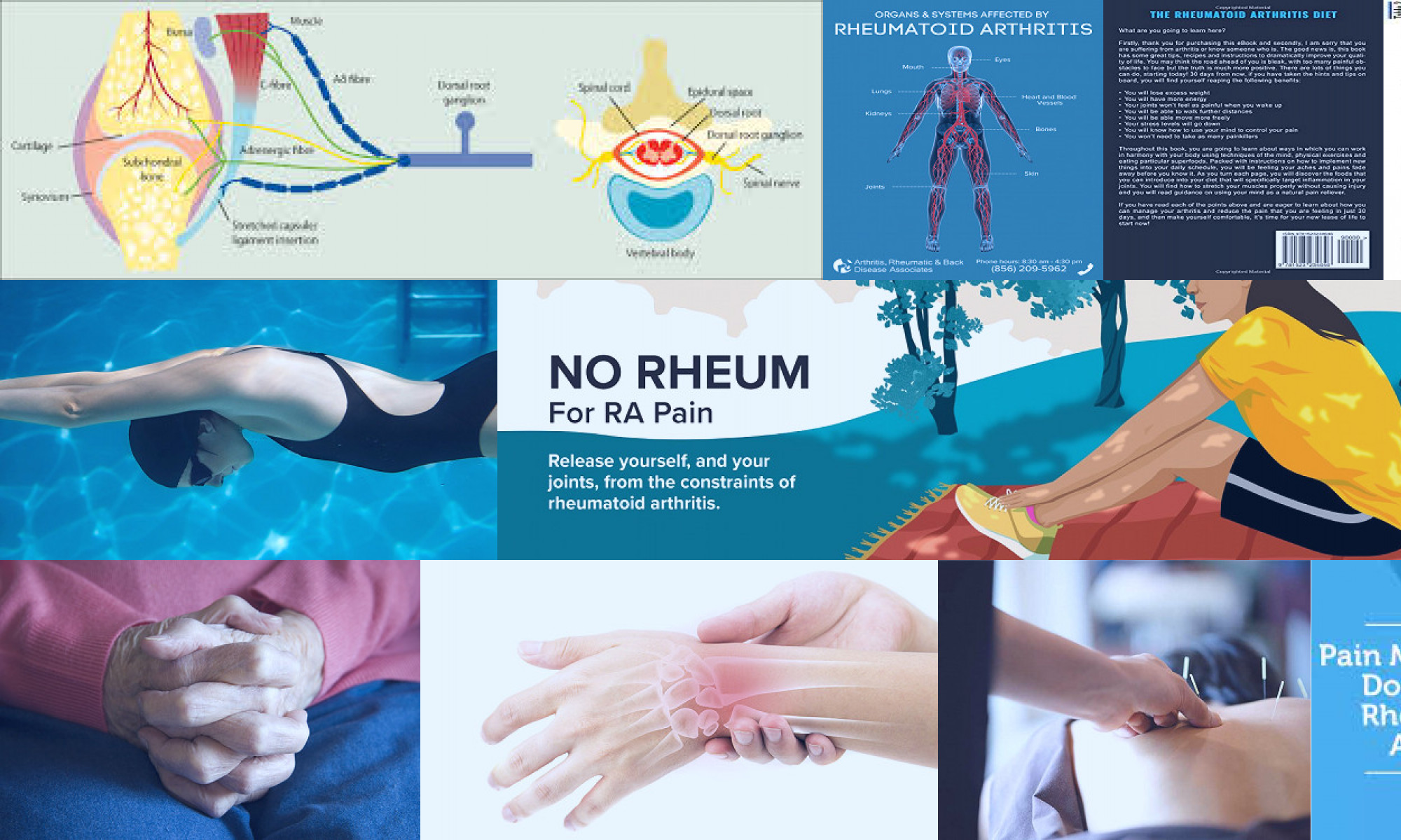 pain management for rheumatoid arthritis that might surprise you