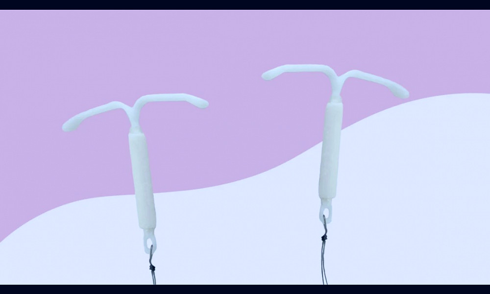 IUD Brands: Comparing Mirena, Paragard, Skyla, Liletta, Kyleena