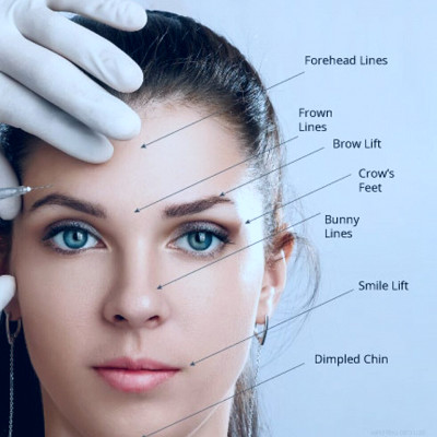 Botox: Anti-Aging Artistry In Stamford CT