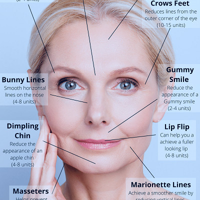 Bring Out Your Beauty With Botox - Doctor Nyla Medispa