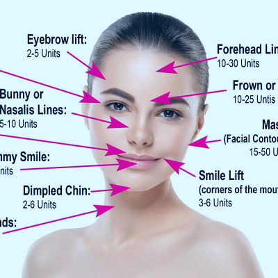 Botox Injection Sites: What Facial Areas Can Be Treated With Botox?